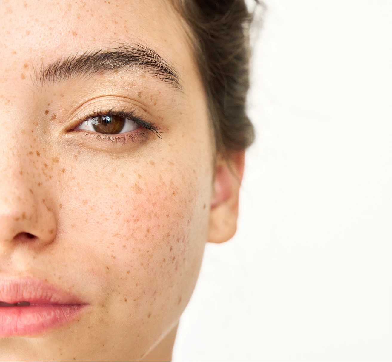 Brow Lift
