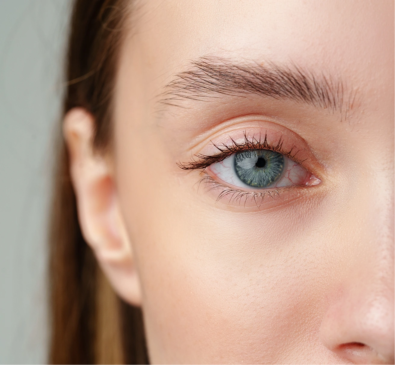 Eyelid Surgery