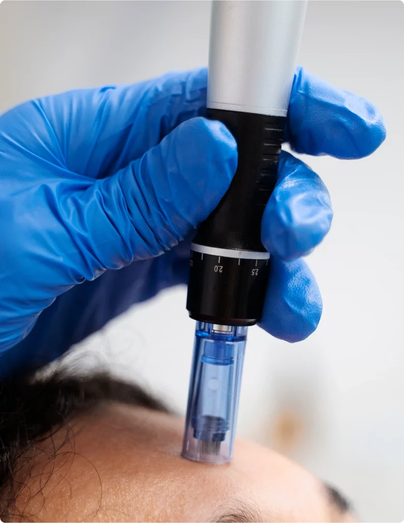 Scar Treatment Options in Scottsdale Banner