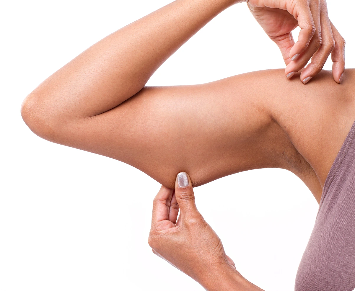 What Is an Arm Lift? Banner