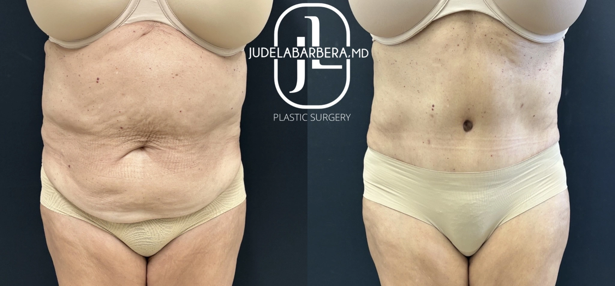 eZy Watermark_10-11-2025_10-24-26-2660AM