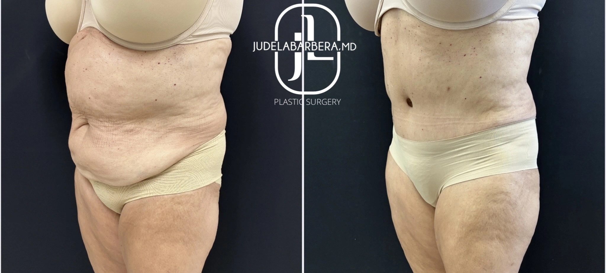 eZy Watermark_10-11-2025_10-24-45-3220AM (1)