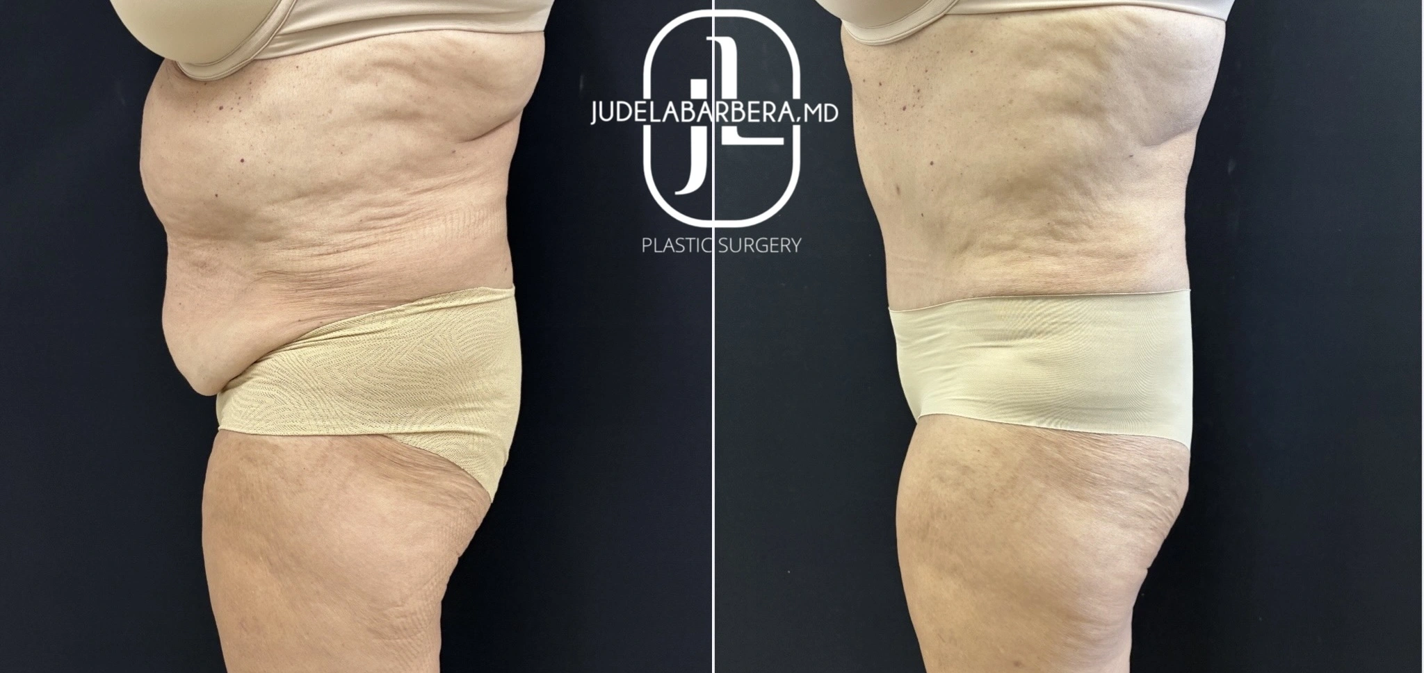 eZy Watermark_10-11-2025_10-25-07-1460AM