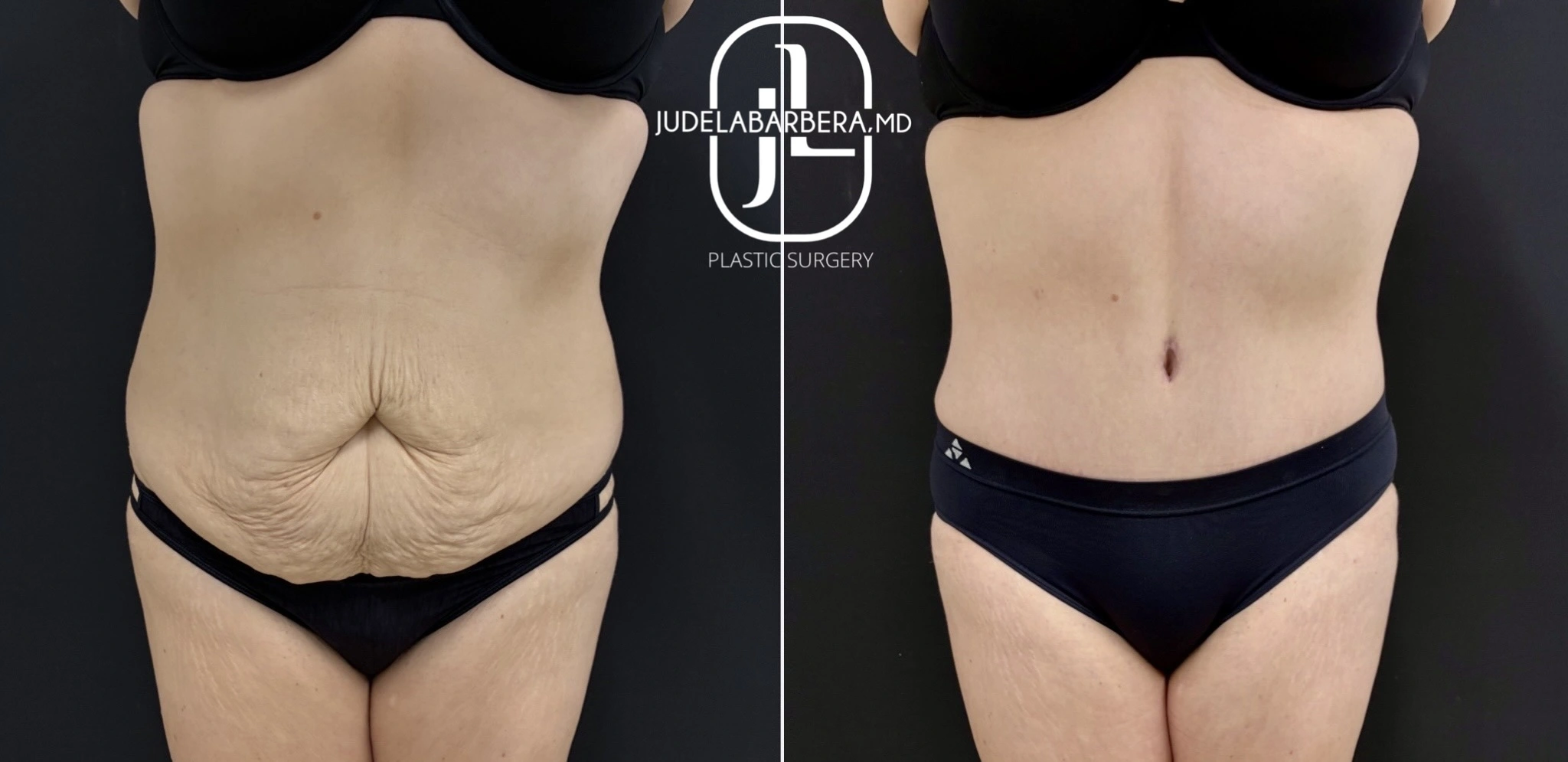 eZy Watermark_13-11-2025_02-59-08-5880PM