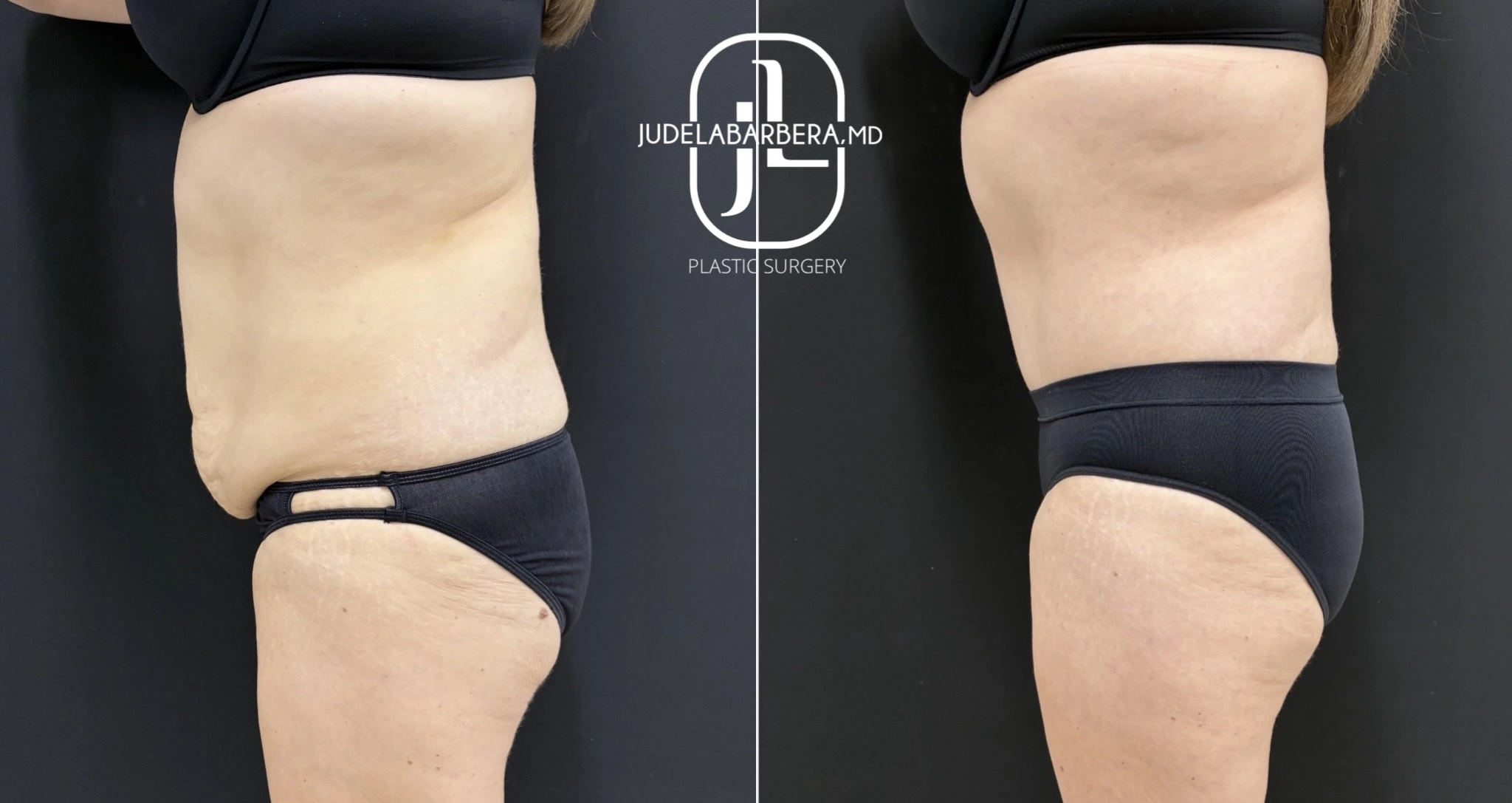 eZy Watermark_13-11-2025_02-59-25-4640PM