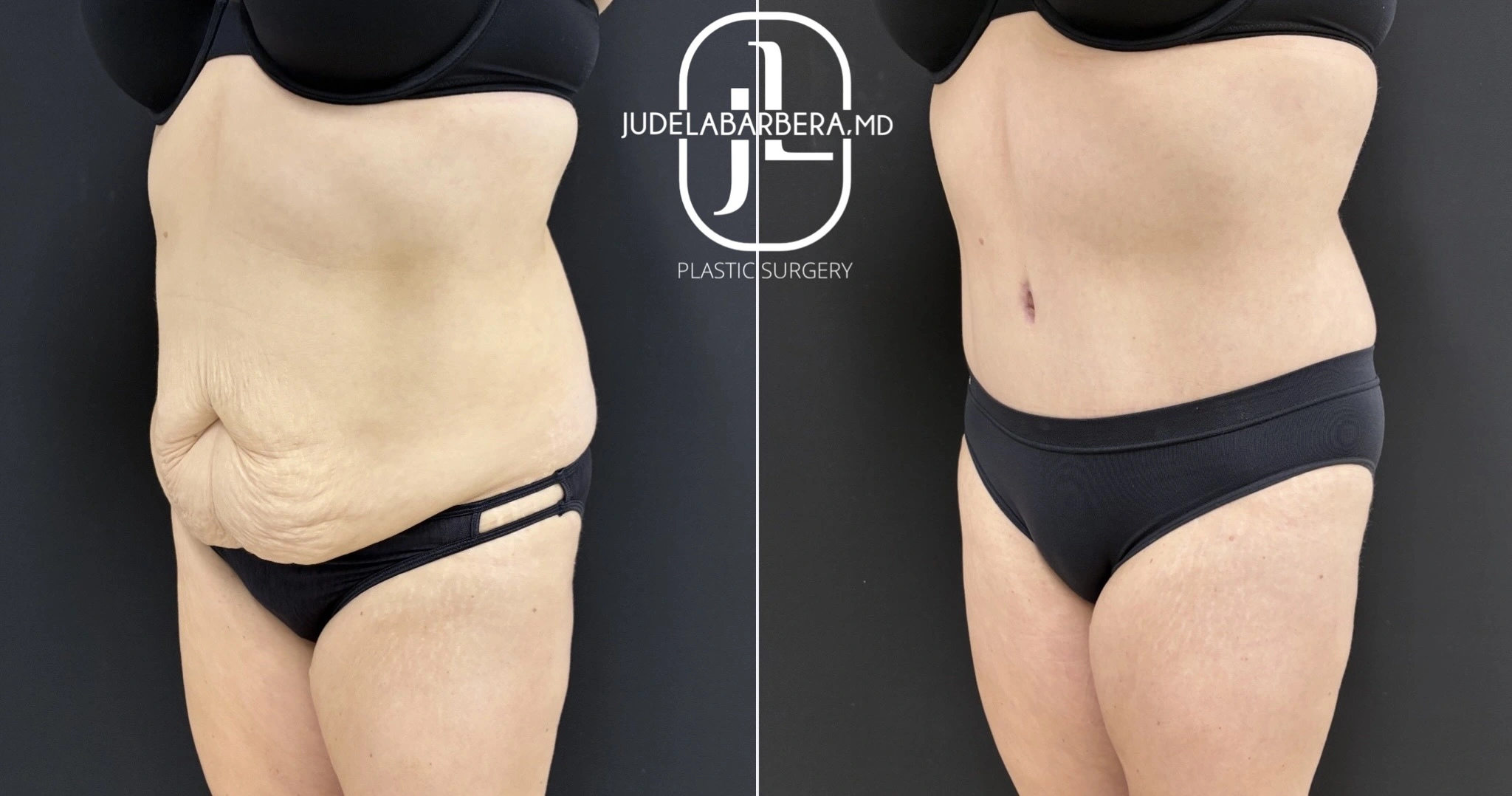 eZy Watermark_13-11-2025_02-59-42-8080PM