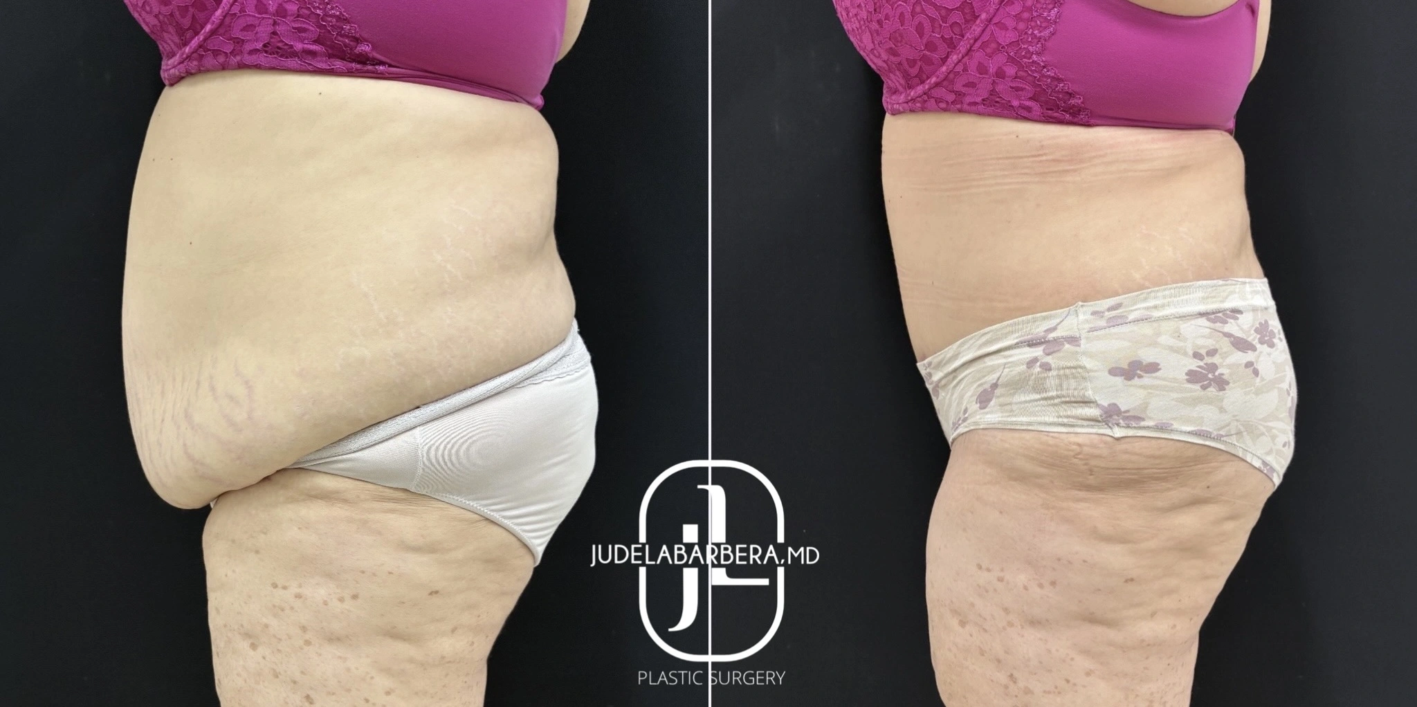 eZy Watermark_19-11-2025_01-14-16-1440PM