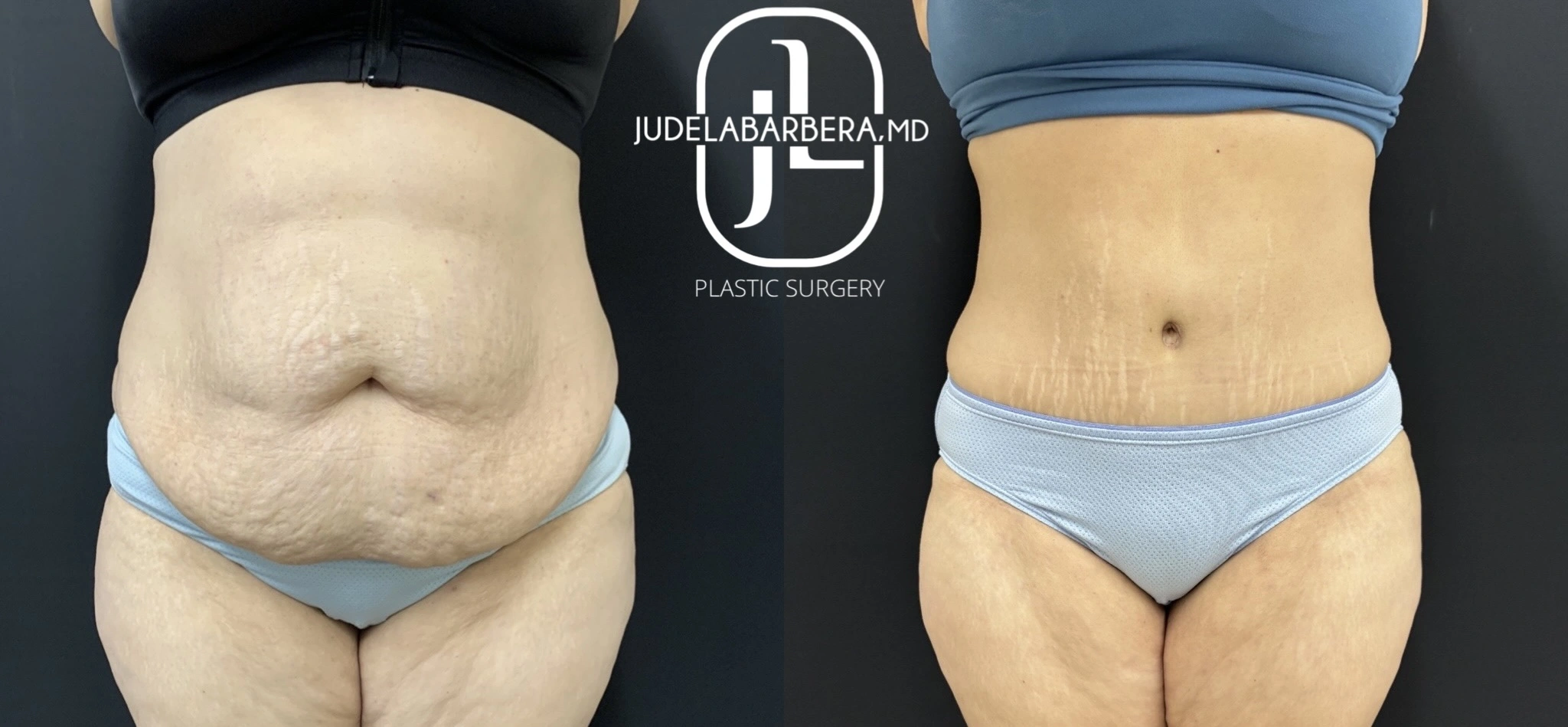 eZy Watermark_21-11-2025_11-33-19-8010AM