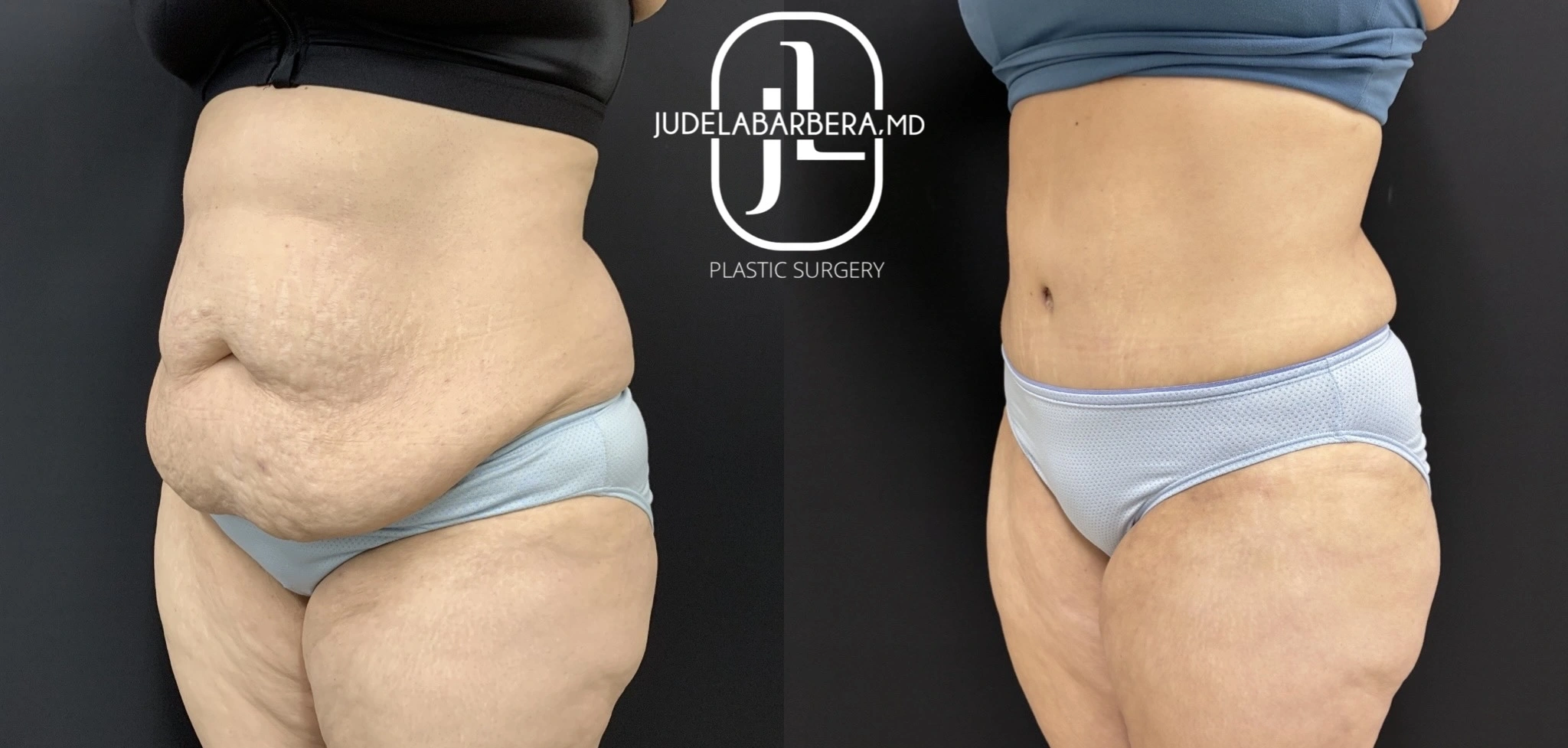 eZy Watermark_21-11-2025_11-33-39-3030AM