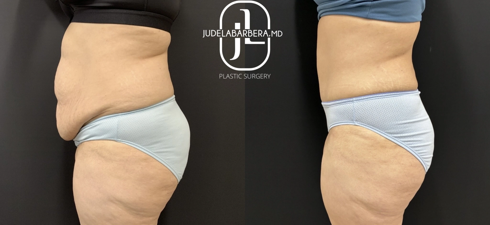 eZy Watermark_21-11-2025_11-34-02-0030AM