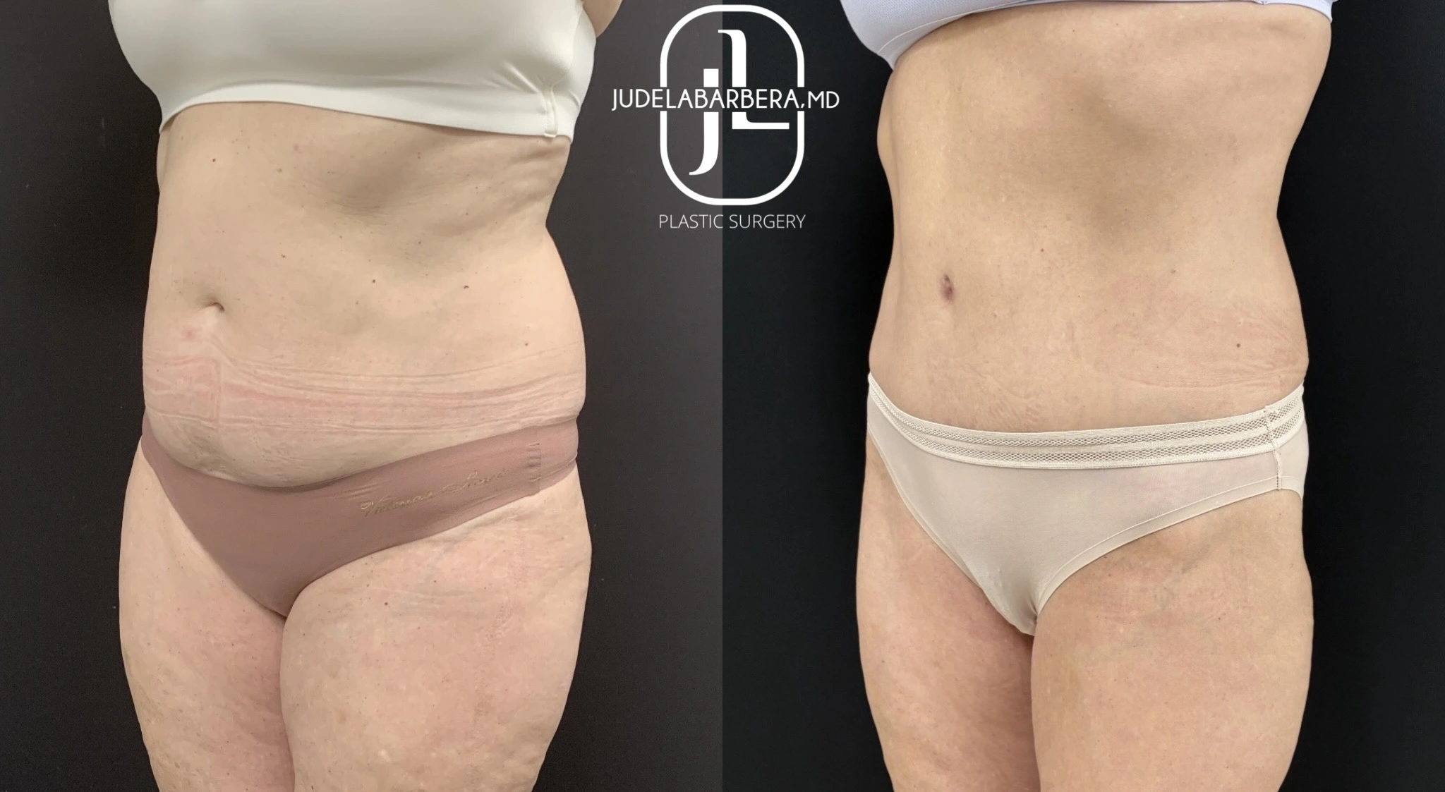 eZy Watermark_03-12-2025_01-48-21-7600PM