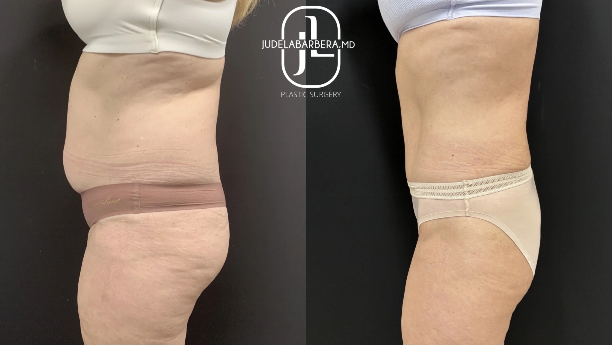 eZy Watermark_03-12-2025_01-48-38-1360PM