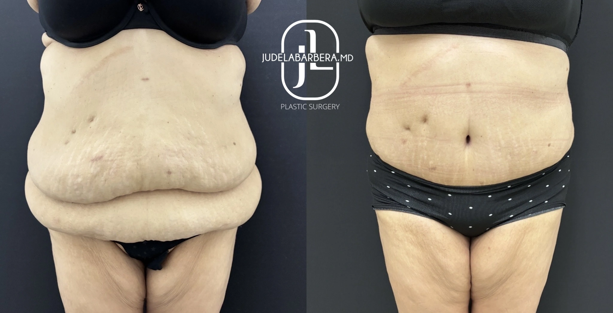 eZy Watermark_05-12-2025_11-13-34-4560AM