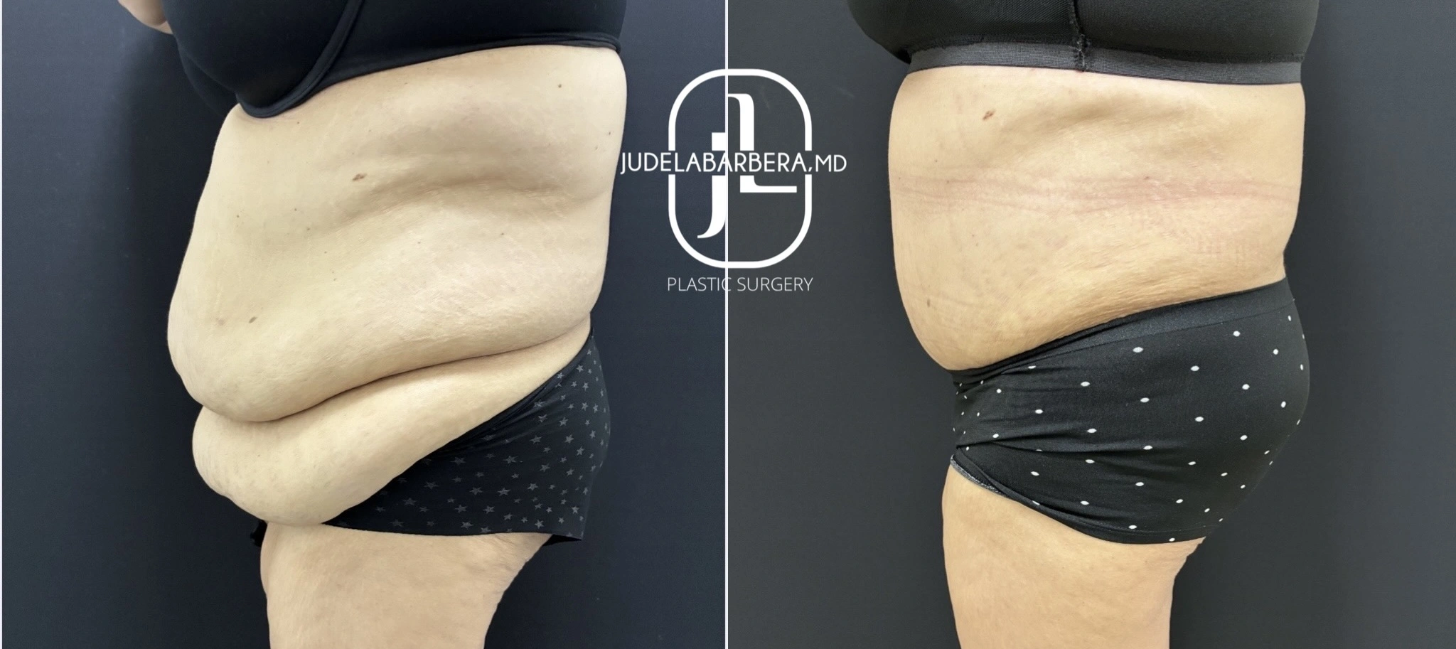 eZy Watermark_05-12-2025_11-13-59-8460AM