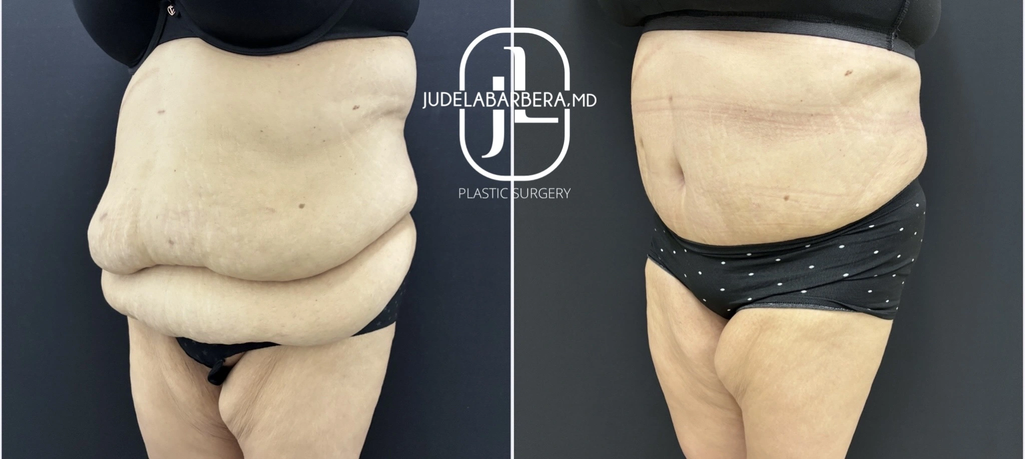 eZy Watermark_05-12-2025_11-14-18-7820AM