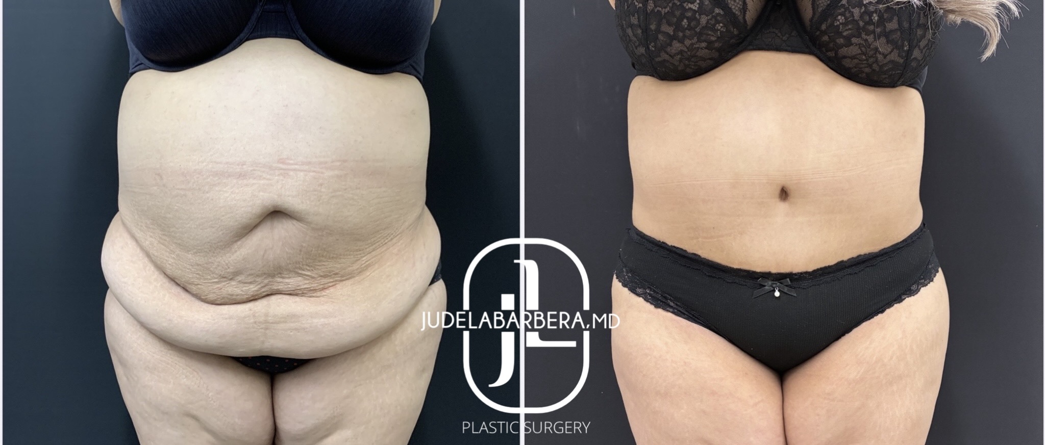 eZy Watermark_30-12-2025_03-18-16-7920PM