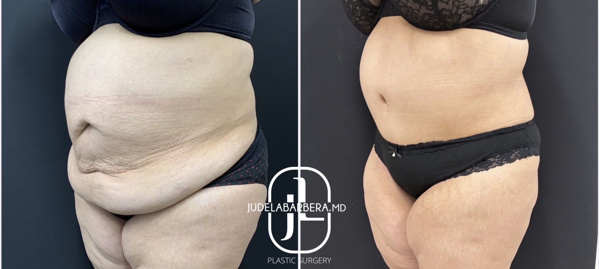 eZy Watermark_30-12-2025_03-18-36-5450PM