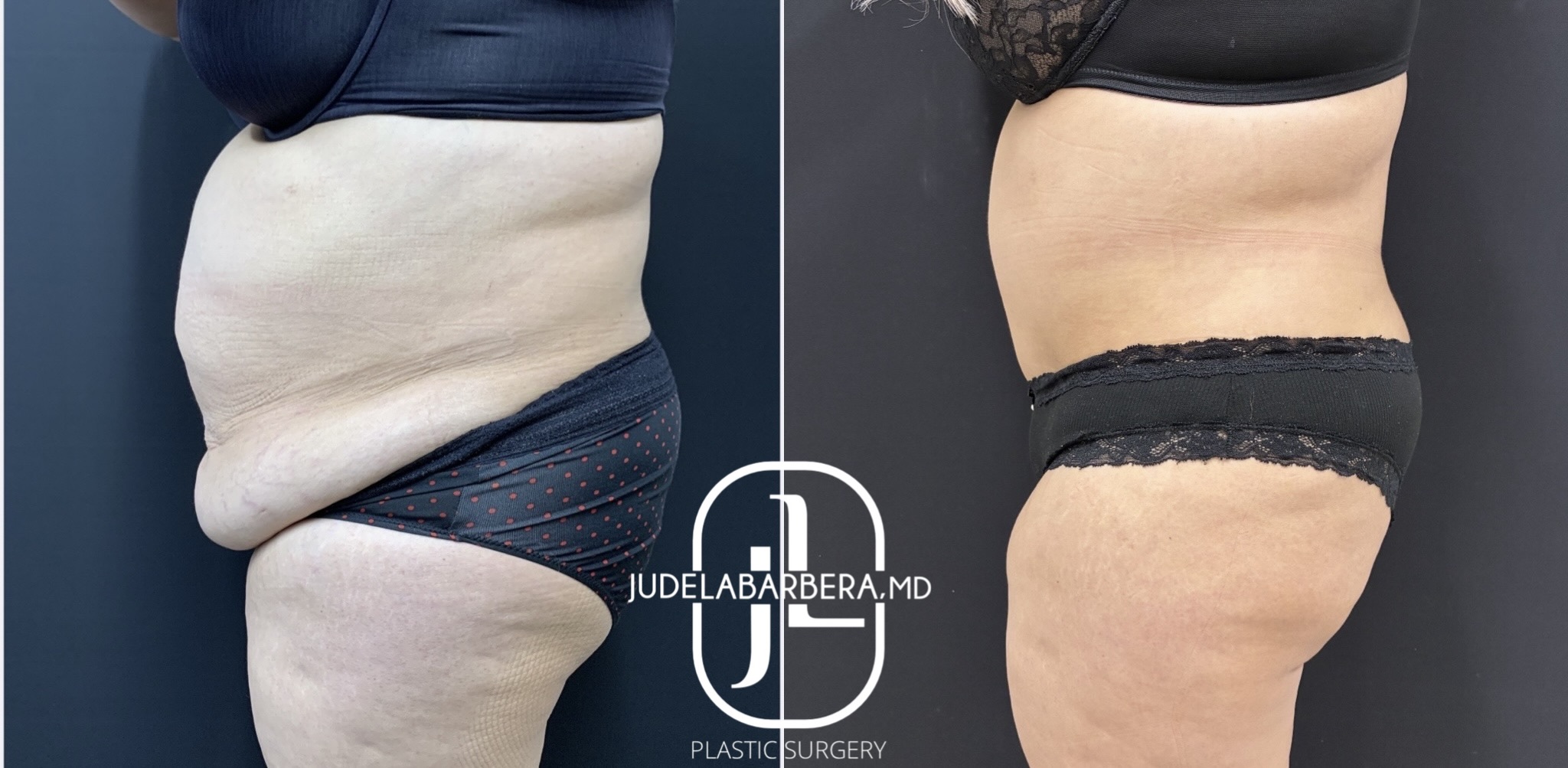 eZy Watermark_30-12-2025_03-18-56-9540PM