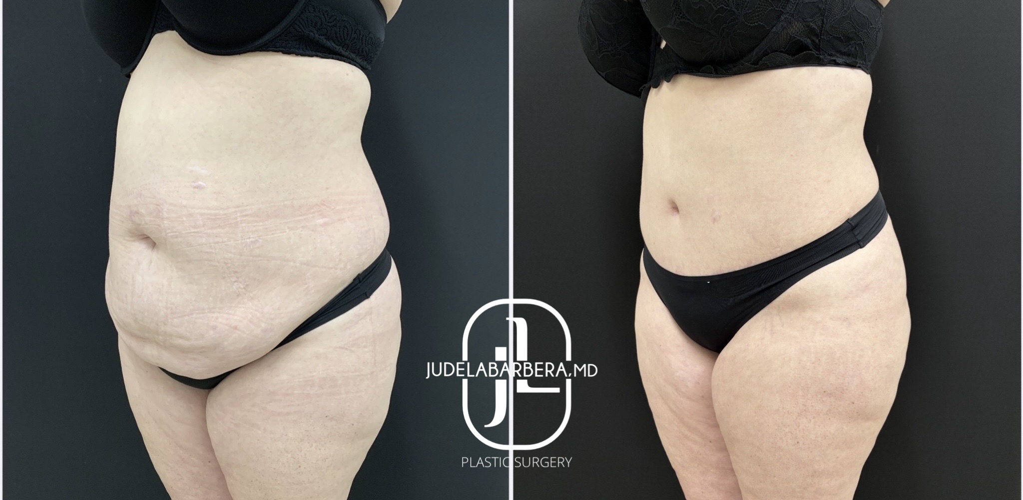 eZy Watermark_02-02-2026_03-09-43-9910PM