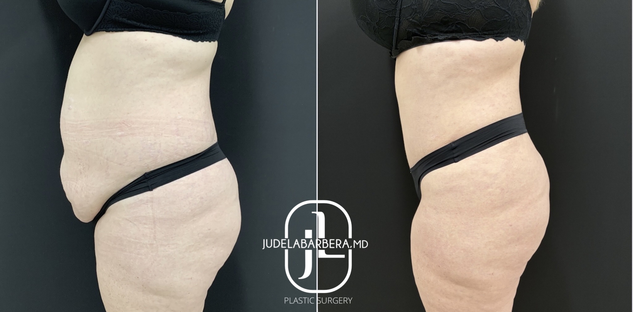 eZy Watermark_02-02-2026_03-09-59-5380PM