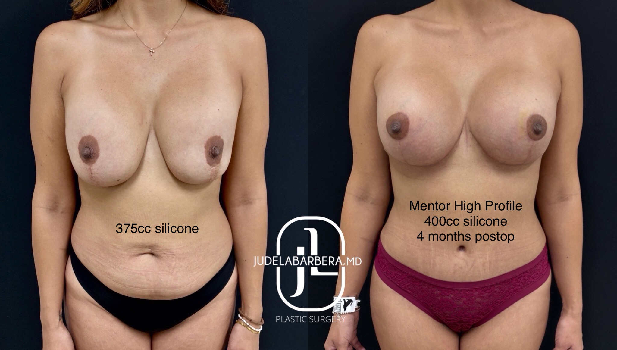 eZy Watermark_23-01-2026_01-09-00-7380PM