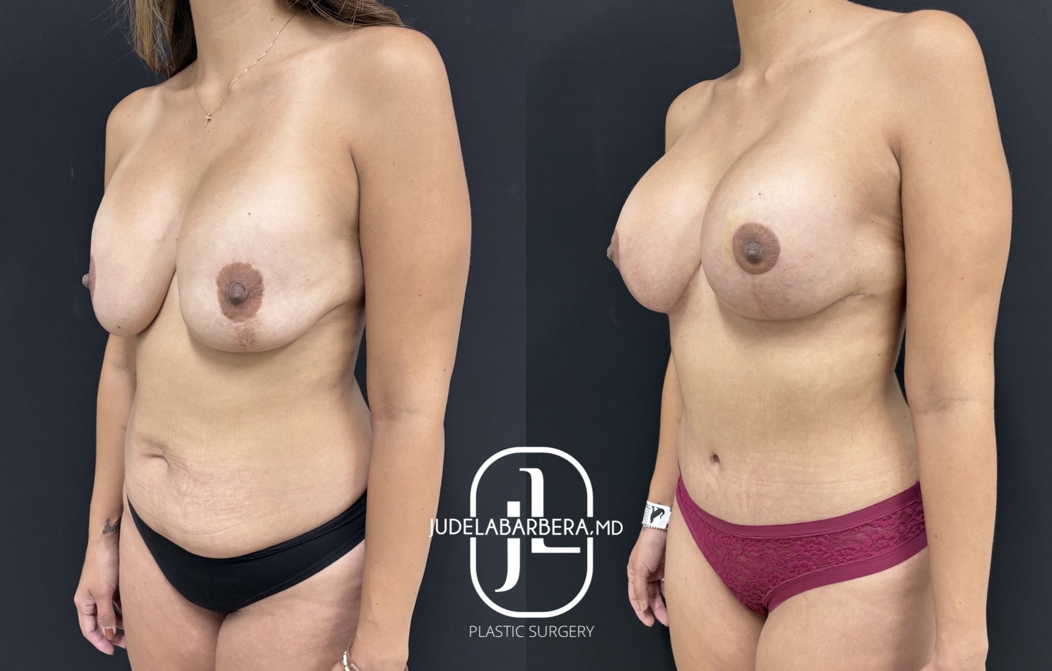 eZy Watermark_23-01-2026_01-09-17-2980PM