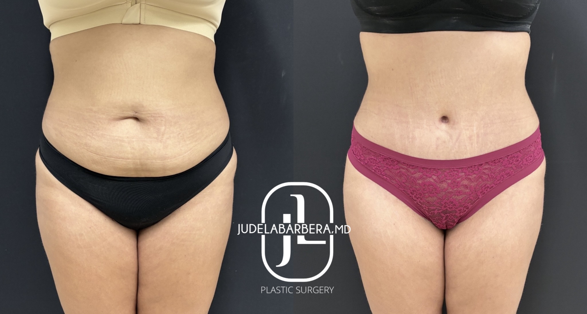 eZy Watermark_23-01-2026_01-12-05-2840PM