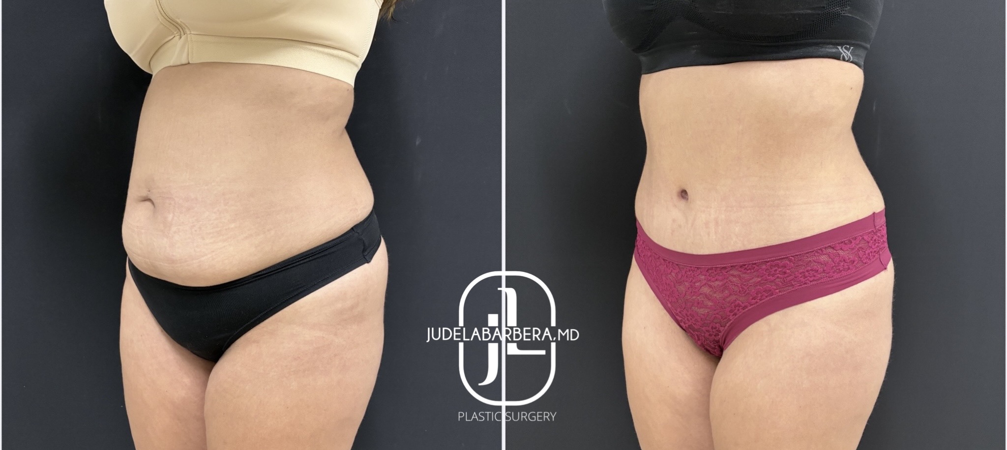 eZy Watermark_23-01-2026_01-12-24-7250PM (1)