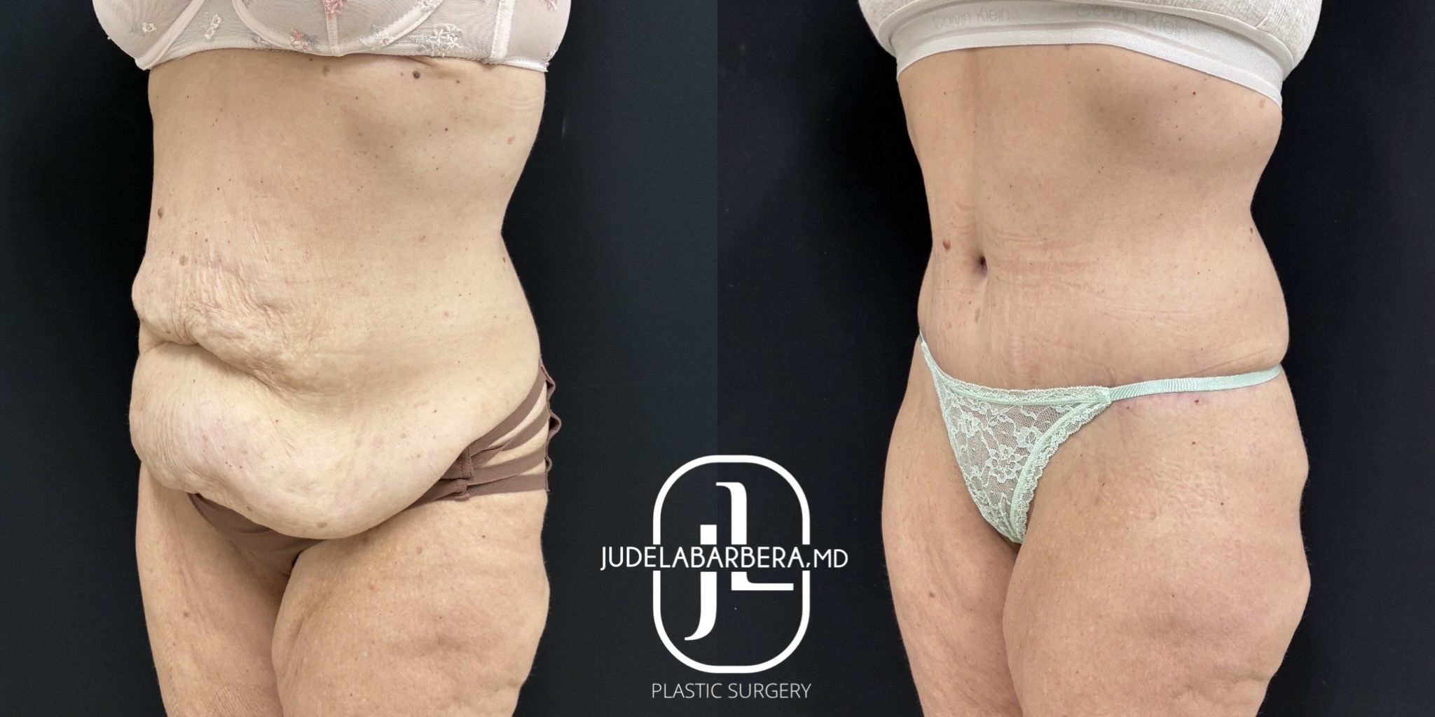 eZy Watermark_27-01-2026_01-36-01-1890PM