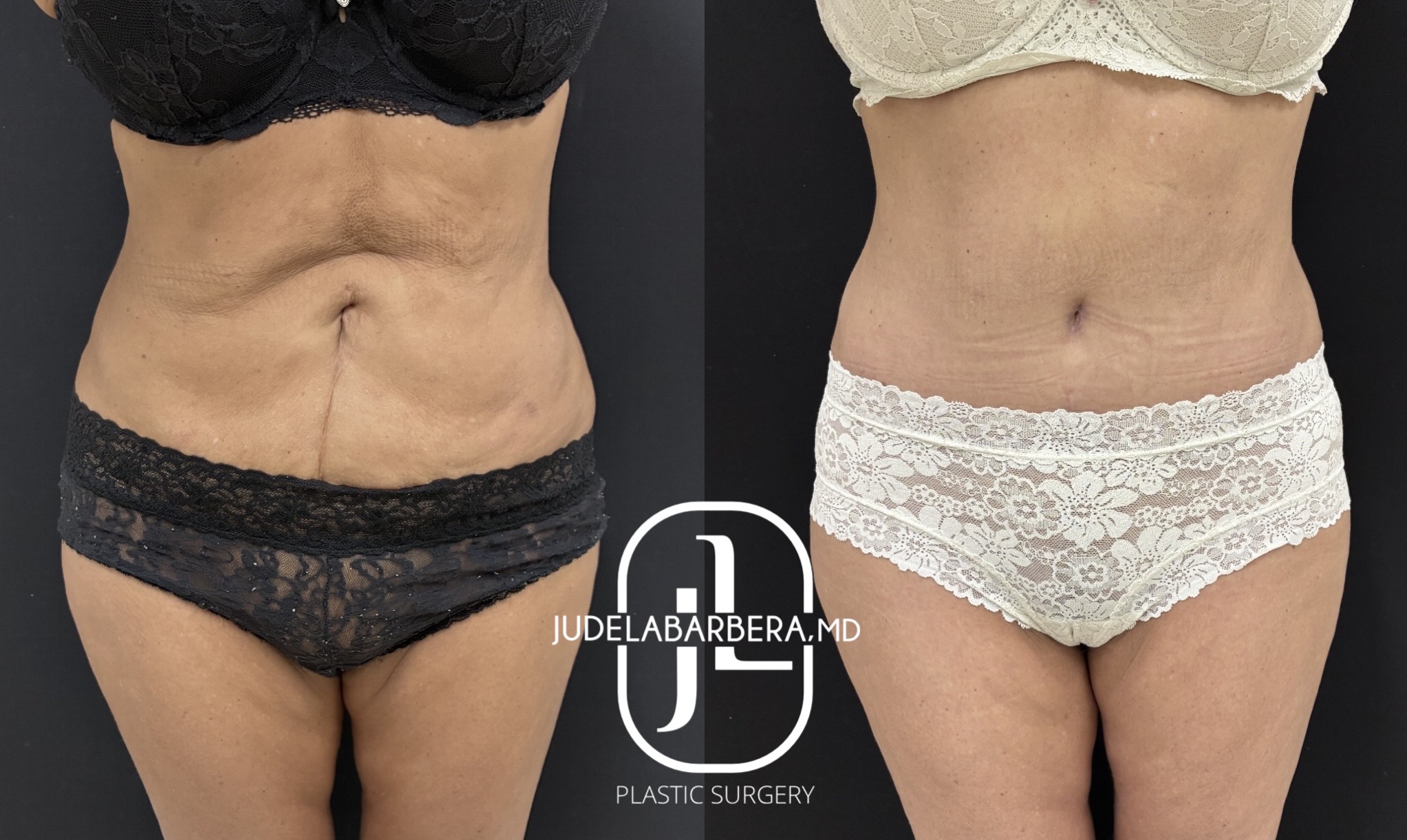 eZy Watermark_30-01-2026_03-27-14-8970PM