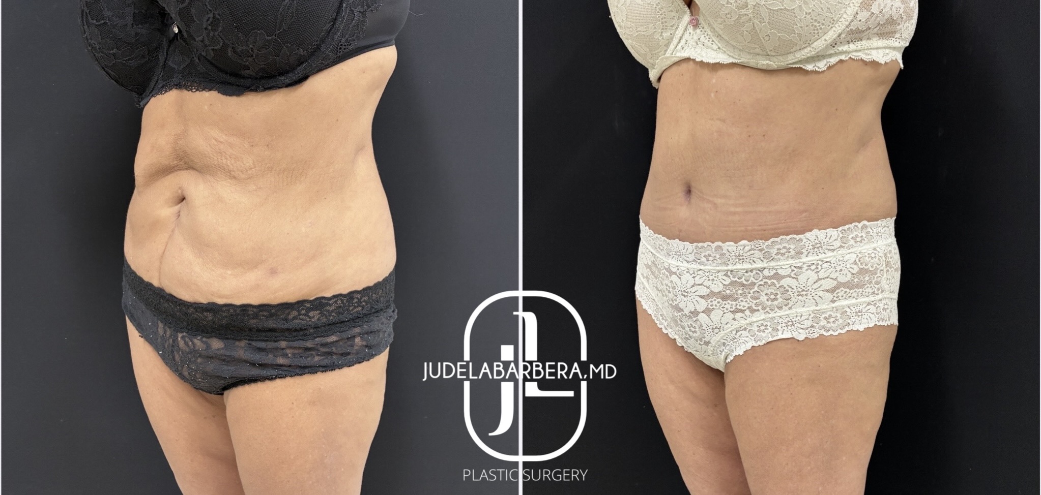 eZy Watermark_30-01-2026_03-27-37-0720PM