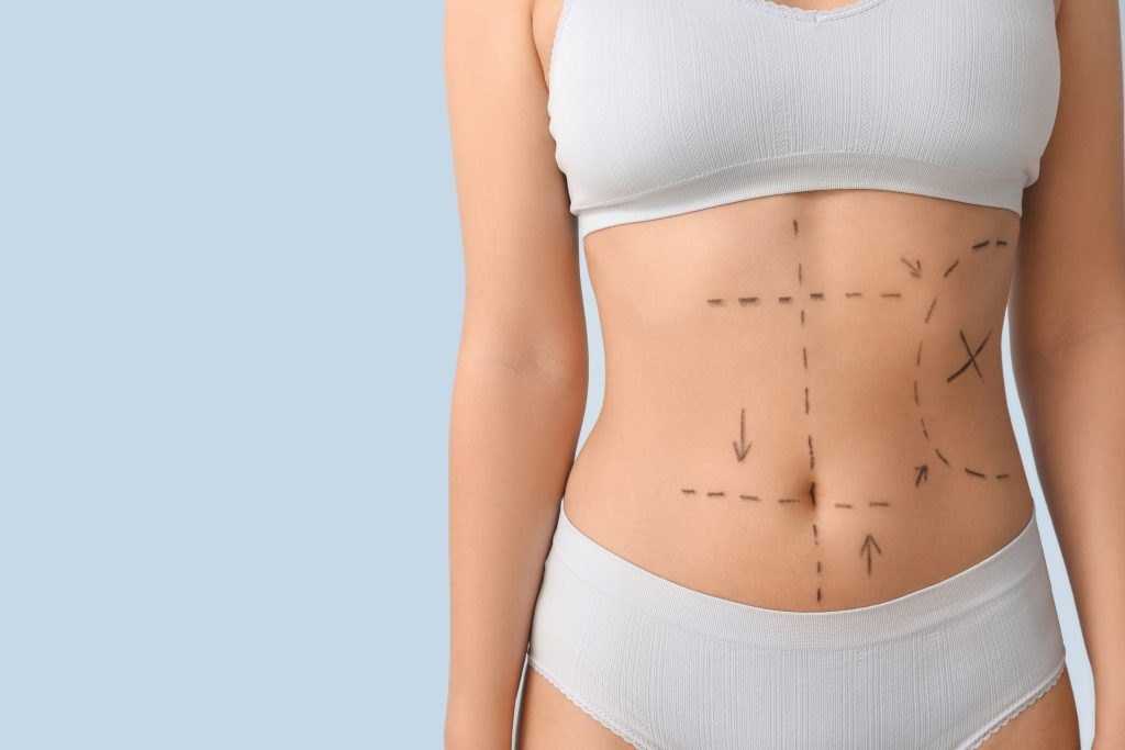 Am I a Good Candidate for Lipo 360? Body Fat, Skin Elasticity, and Goals banner