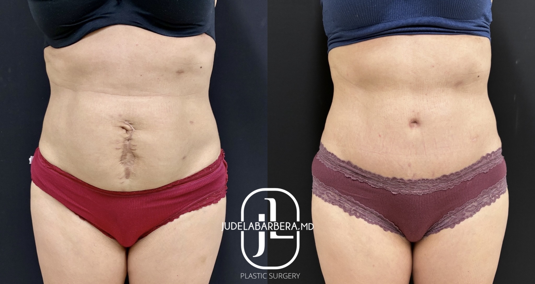 eZy Watermark_10-03-2026_03-31-02-3630PM