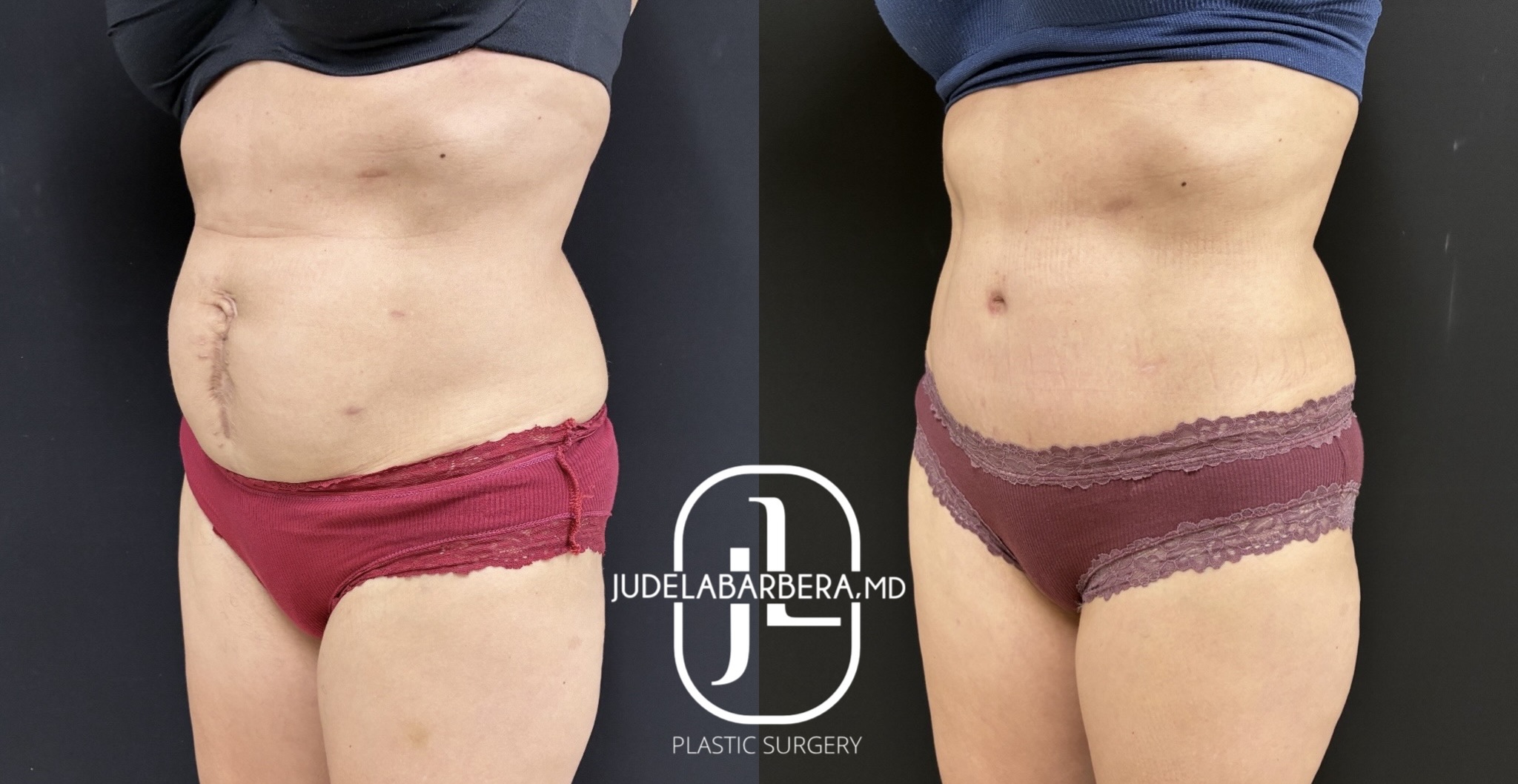 eZy Watermark_10-03-2026_03-31-16-4140PM