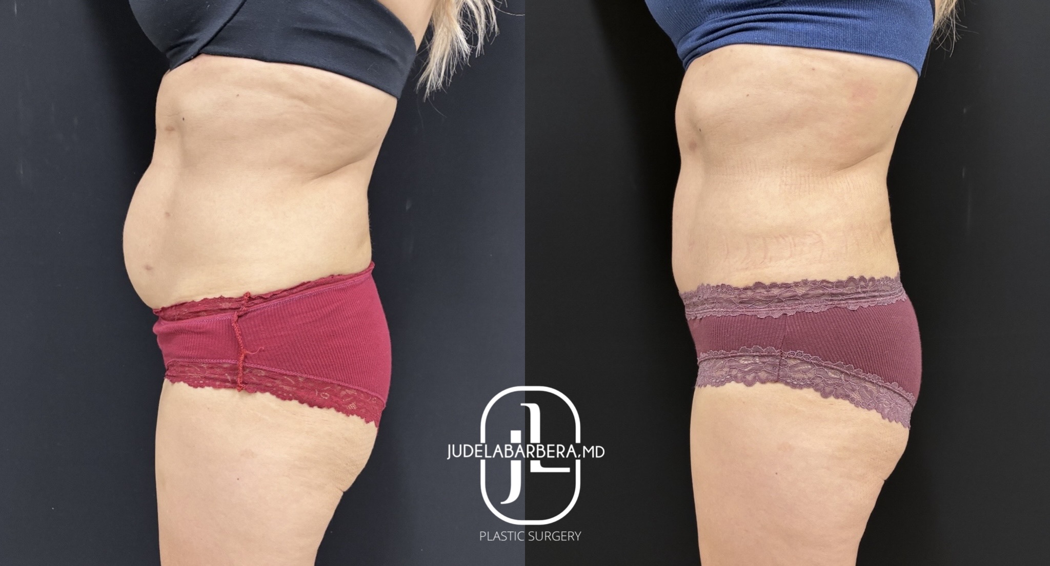 eZy Watermark_10-03-2026_03-31-30-7450PM