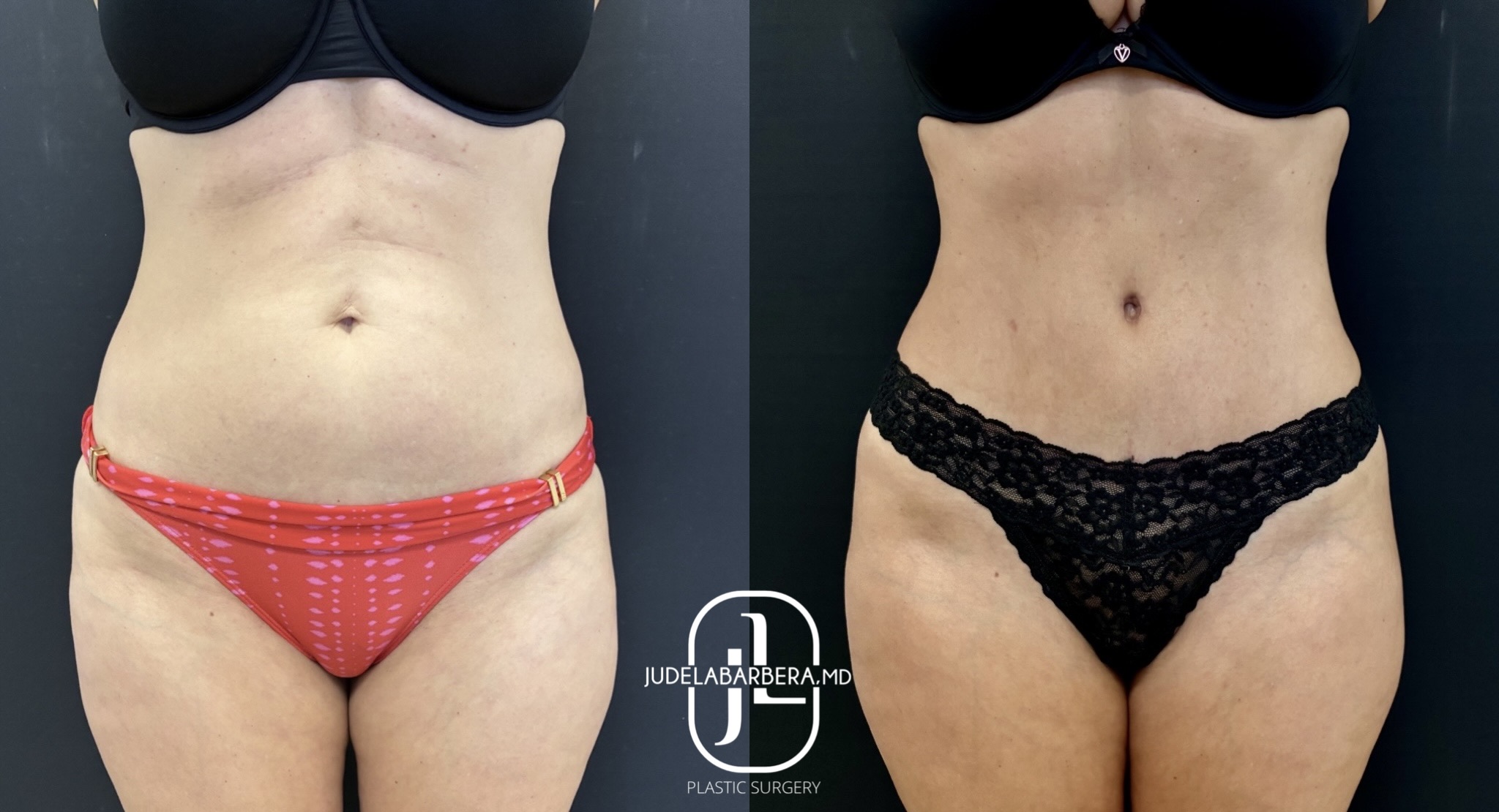 eZy Watermark_11-03-2026_12-24-11-7850PM