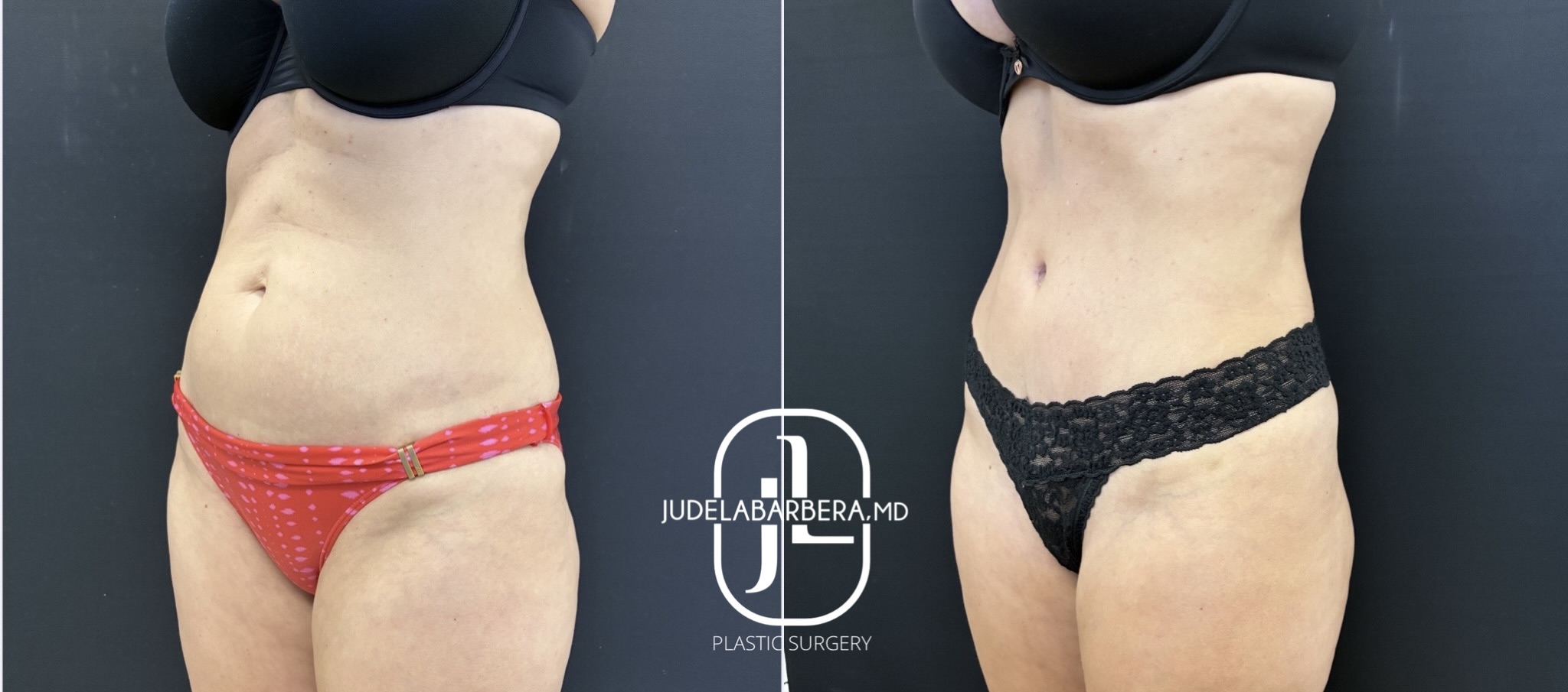 eZy Watermark_11-03-2026_12-24-32-1440PM