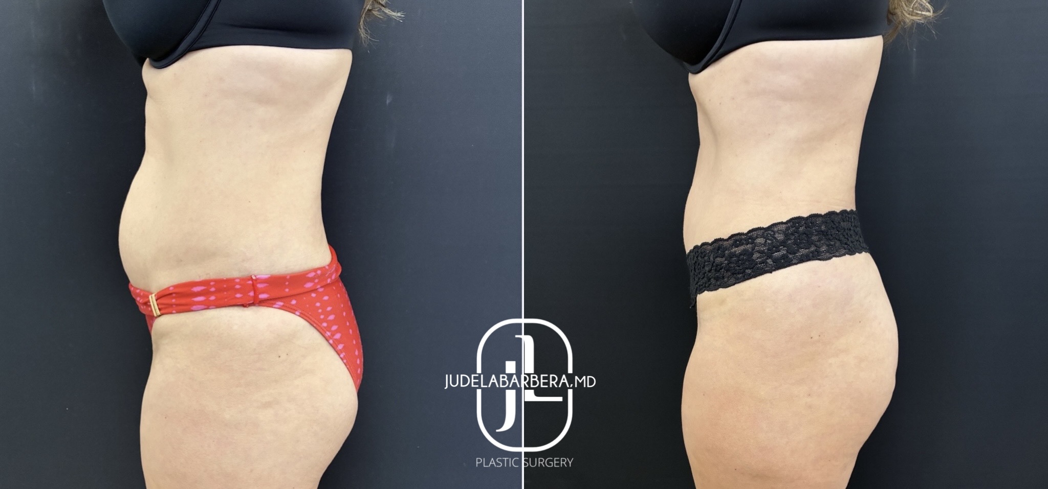 eZy Watermark_11-03-2026_12-24-51-4010PM